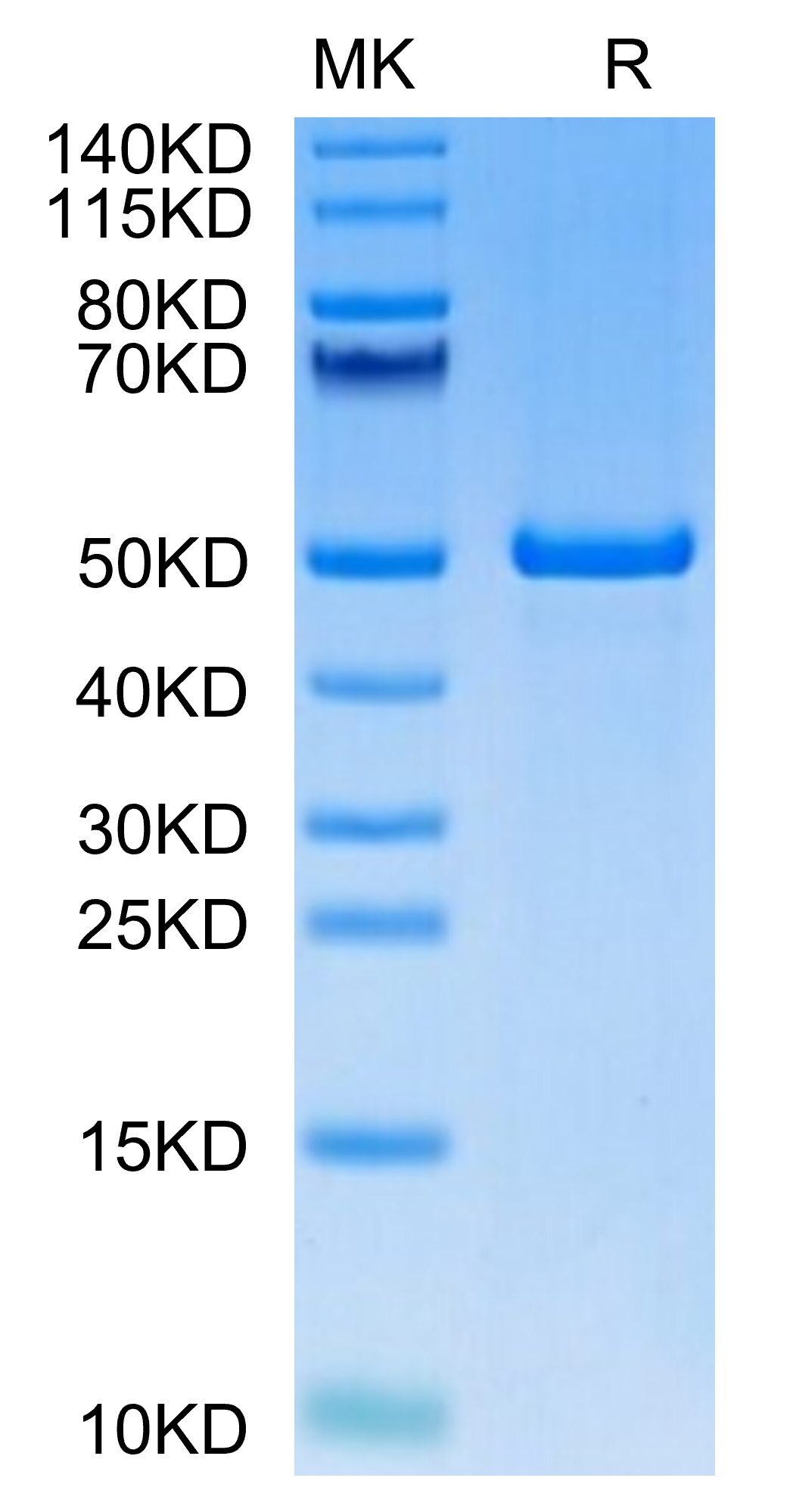 Human ILDR2 Protein (ILD-HM202)