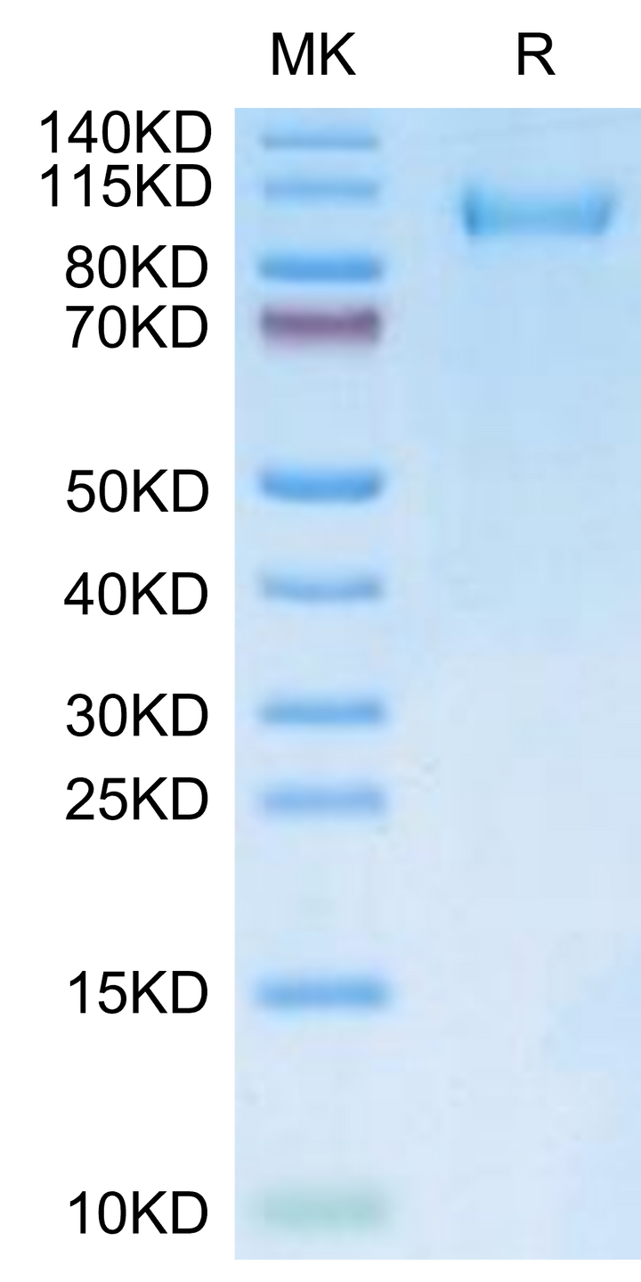 FITC-Labeled Human CDH17/Cadherin 17 Protein (CDH-HM117F)