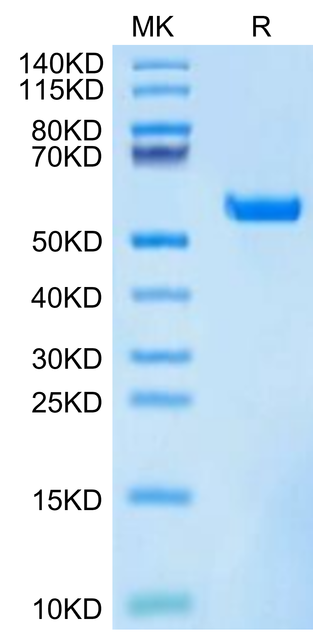 Biotinylated Human HLA-A*11:01&B2M&KRAS WT (VVVGAGGVGK) Monomer Protein, Ultra Low Endotoxin (MHC-HM429B-UL)