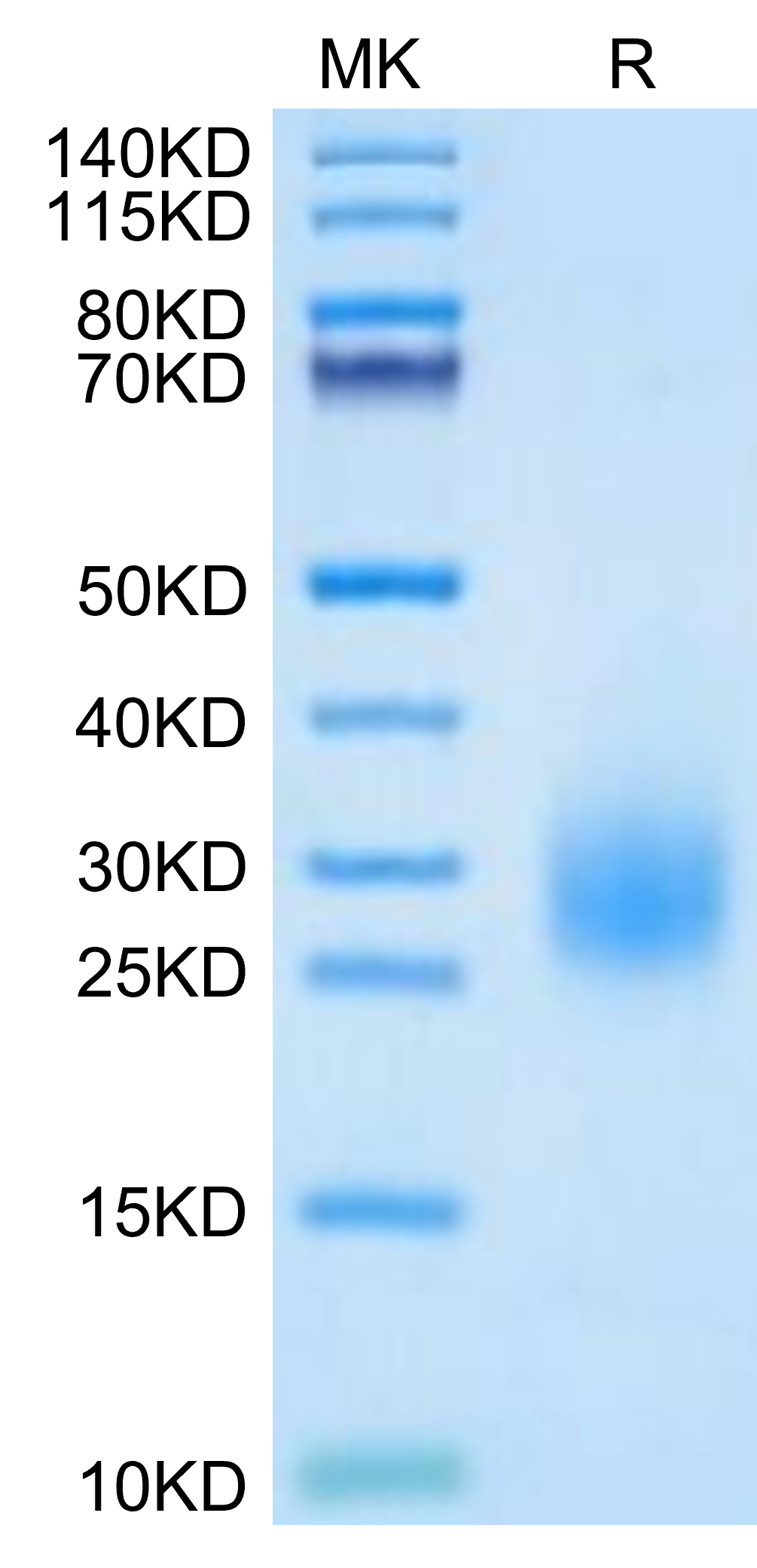 Human uPAR/PLAUR Domain 3 Protein (PAR-HM1D3)