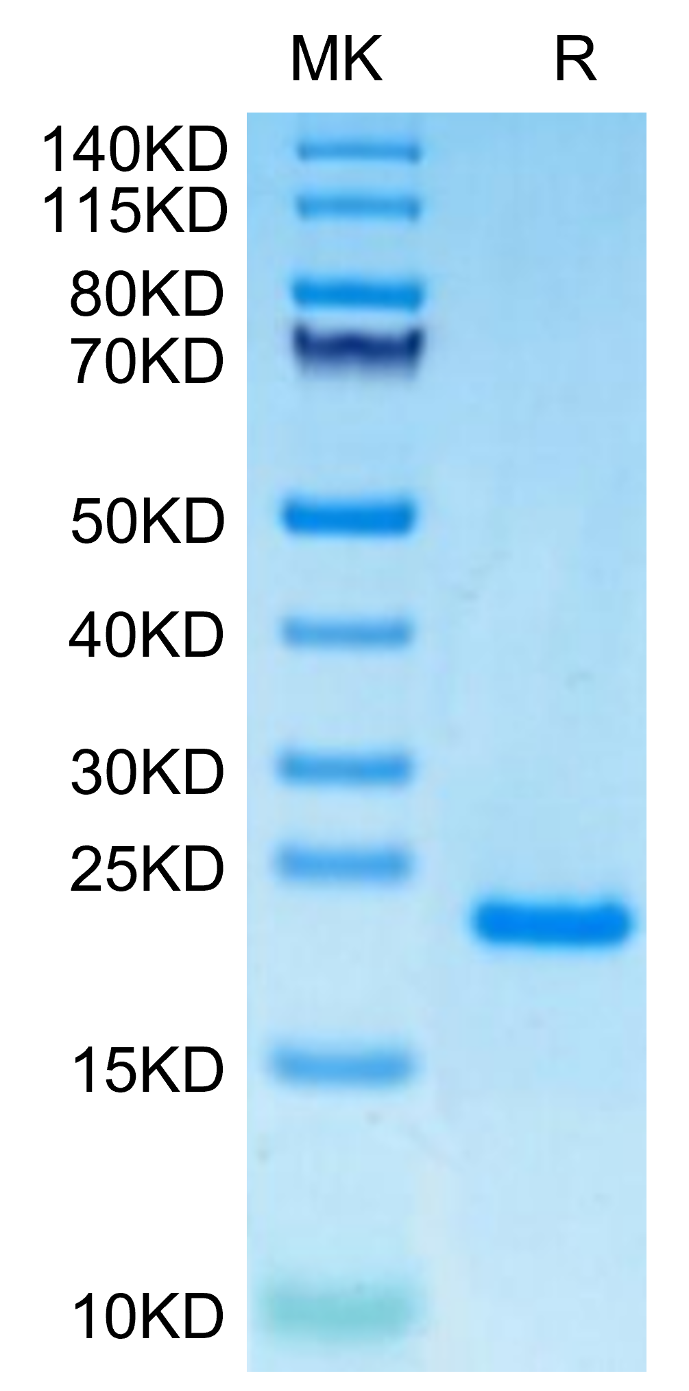 Human PRL-1/PTP4A1 Protein (PRL-HE101)