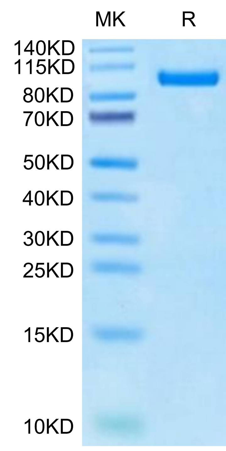 Cynomolgus PTK7/CCK4 Protein, Ultra Low Endotoxin (CCK-CM104-UL)