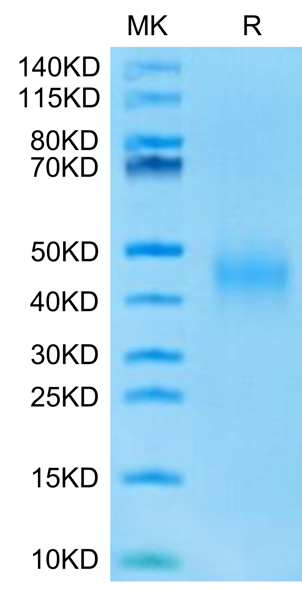 Mouse IL-9-Protein, Ultra Low Endotoxin (IL9-MM101-UL)