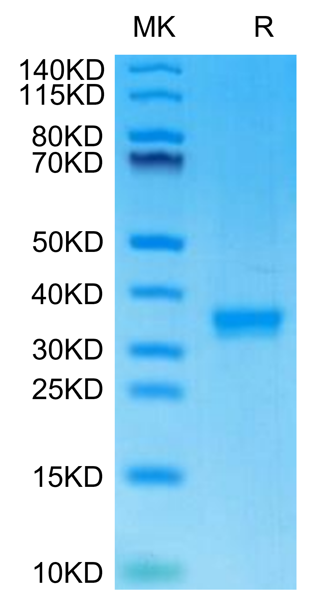 Mouse IgG2C Protein, Ultra Low Endotoxin (IGG-MM02C-UL)