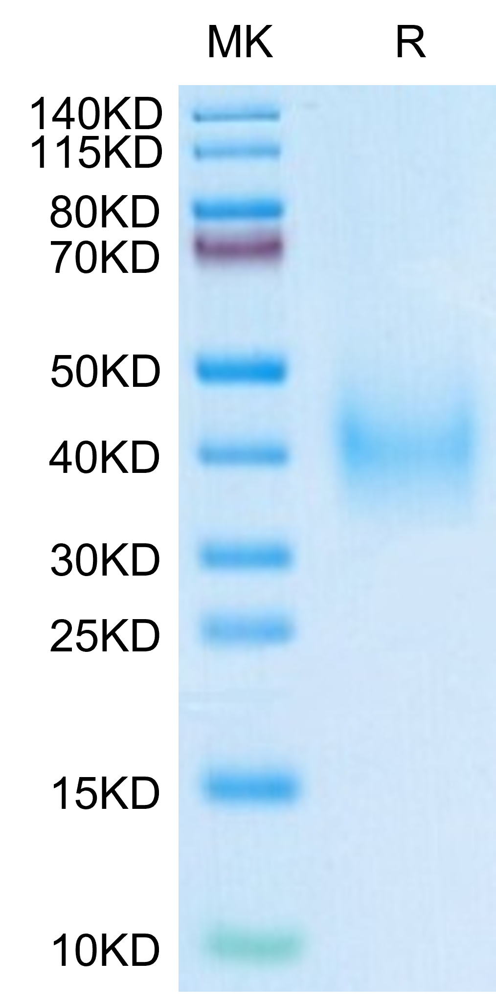 Human uPAR/PLAUR Domain (2+3) Protein, Ultra Low Endotoxin (PAR-HM1D4-UL)