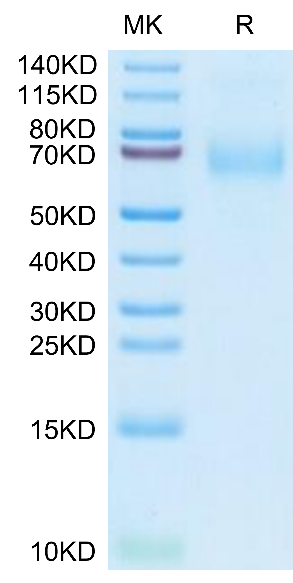 Human MSR1 Protein, Ultra Low Endotoxin (MSR-HM101-UL)