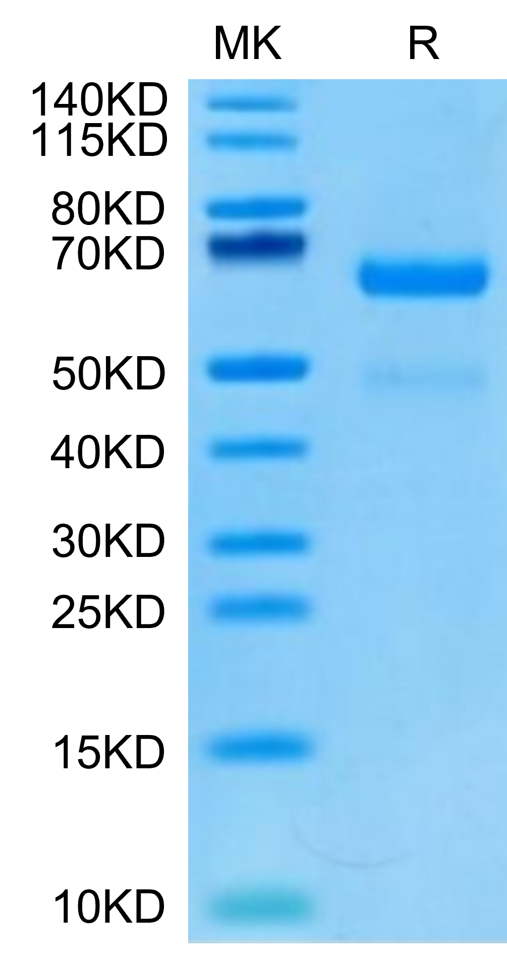 Human LRP10 Protein, Ultra Low Endotoxin (LRP-HM110-UL)