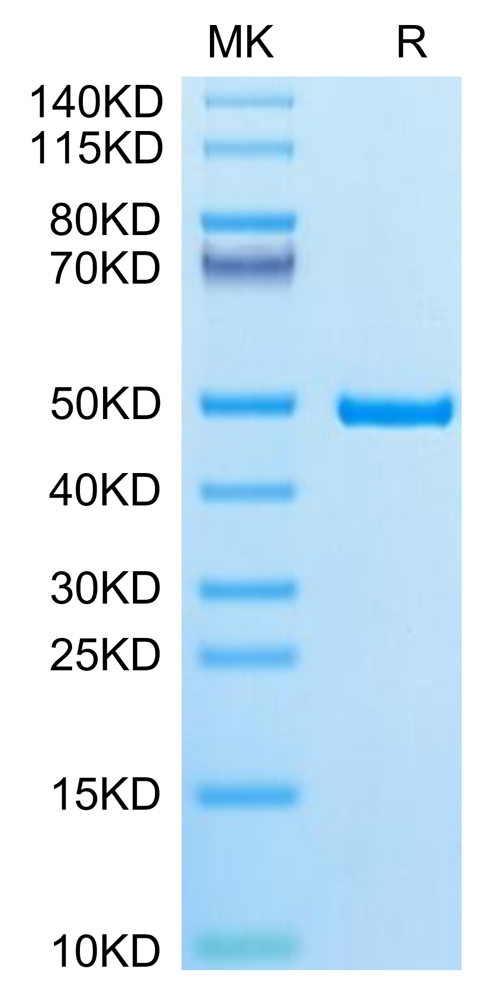 Human IDH1 Protein (IDH-HE101)