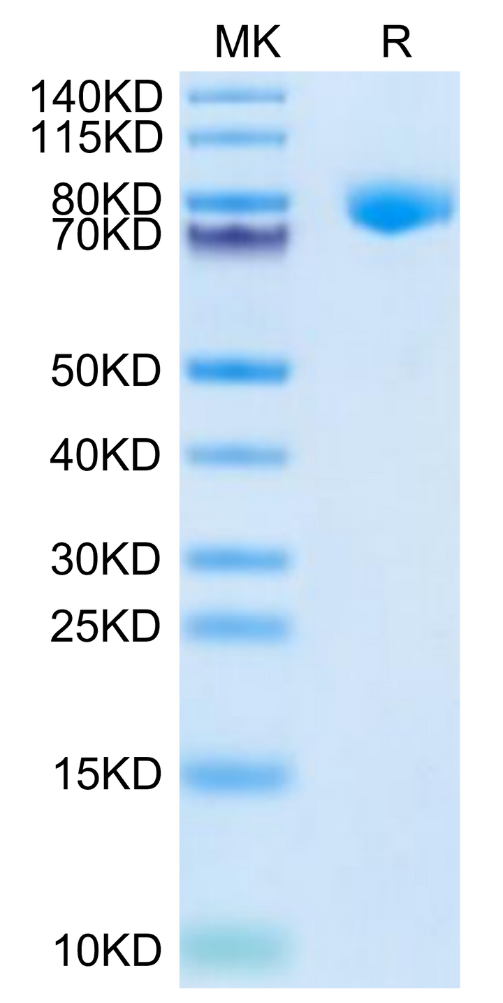 Cynomolgus KLKB1 Protein (KLK-CM1B1)