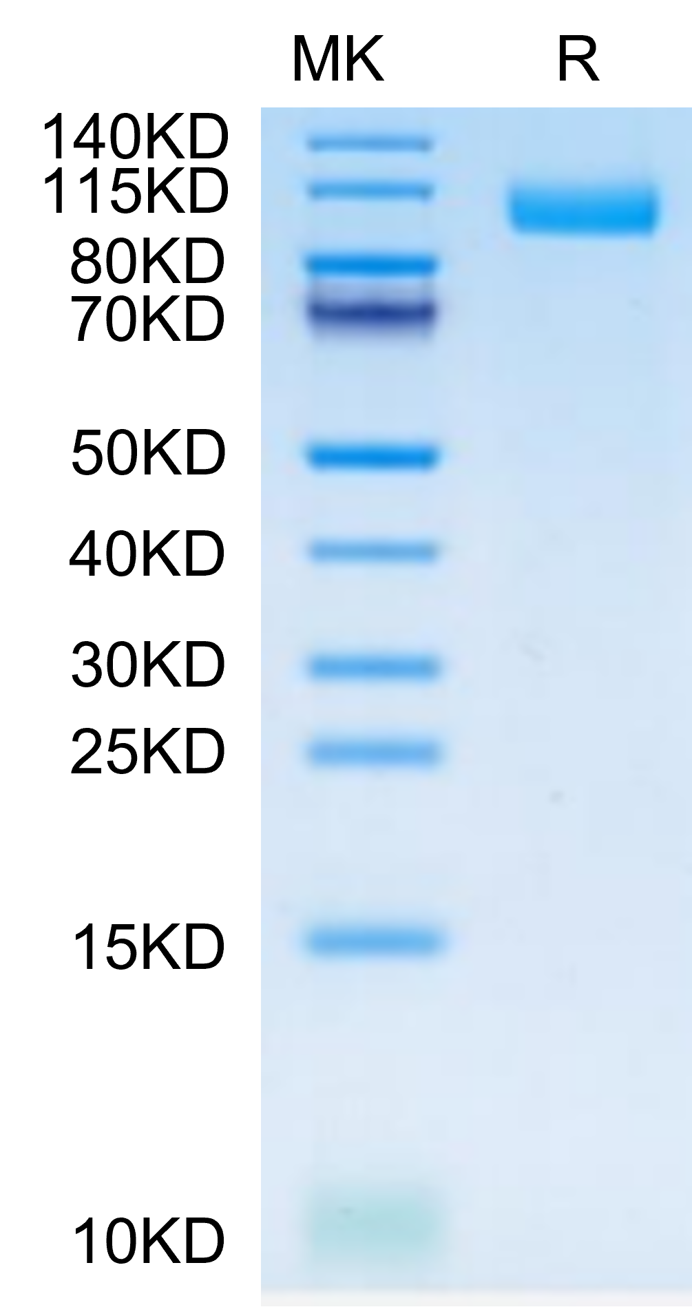 Cynomolgus TLR3 Protein (TLR-CM103)