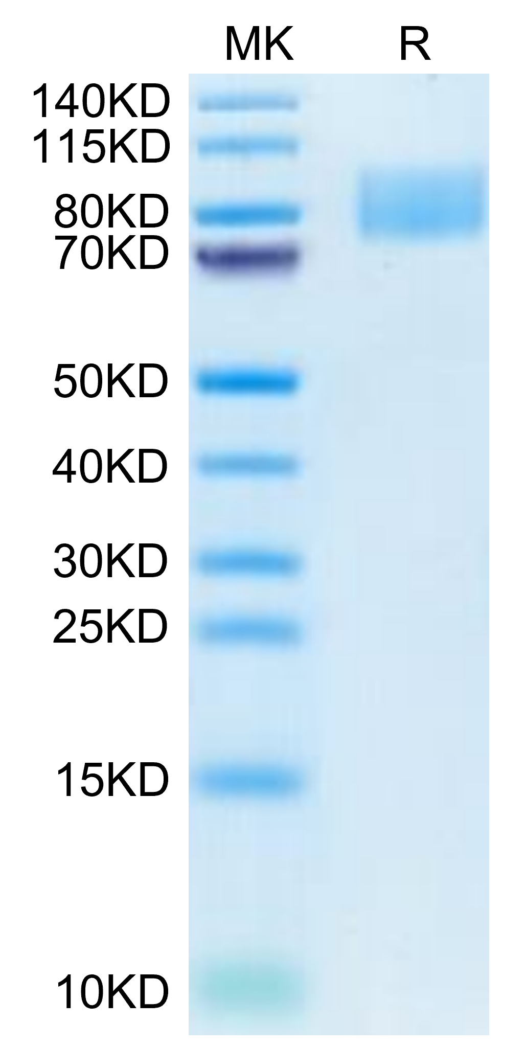 Cynomolgus ICAM-1/CD54 Protein, Ultra Low Endotoxin (ICM-CM101-UL)