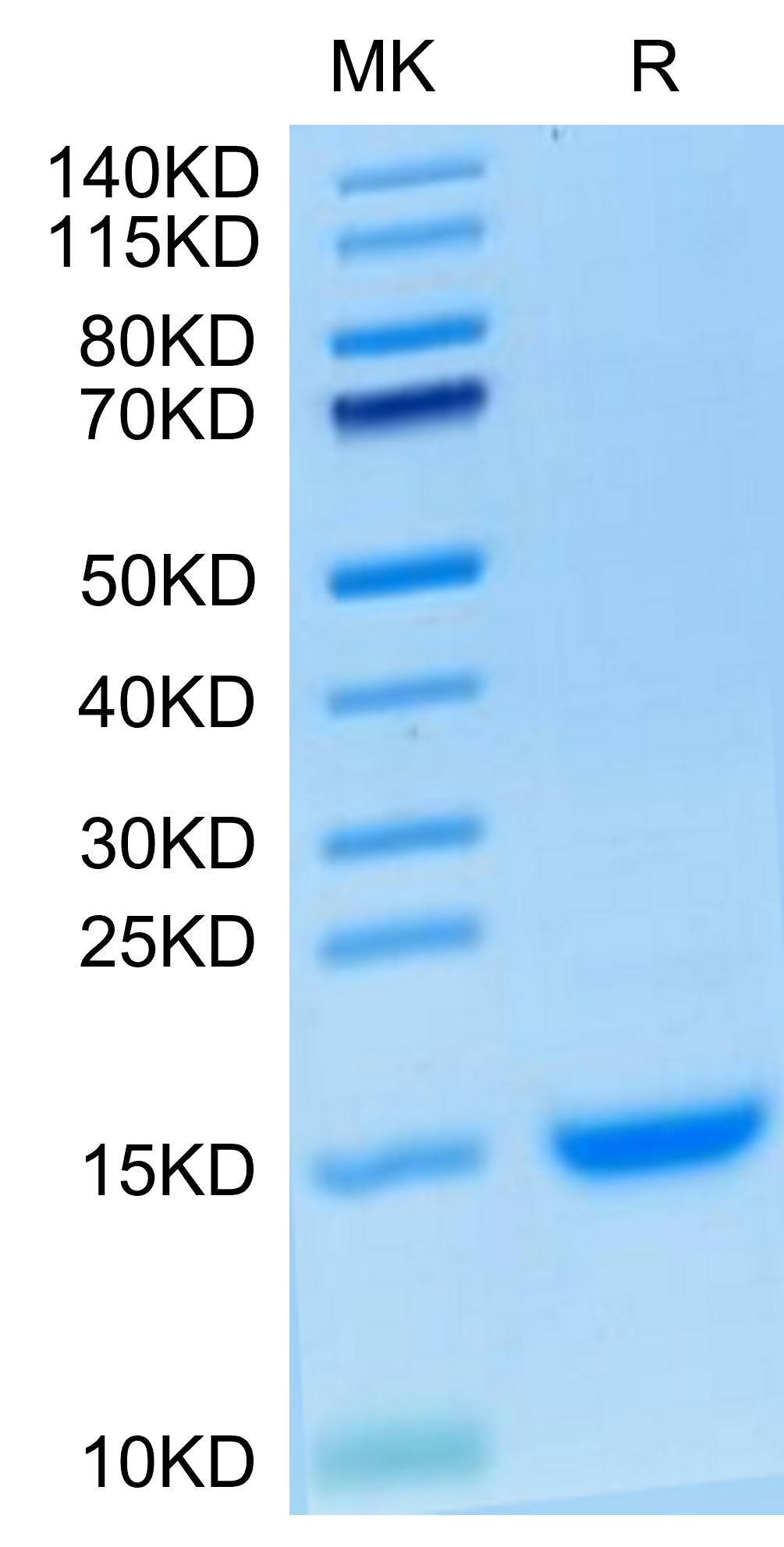 Cynomolgus MCP-1/CCL2 Protein, Ultra Low Endotoxin (MCP-CM101-UL)