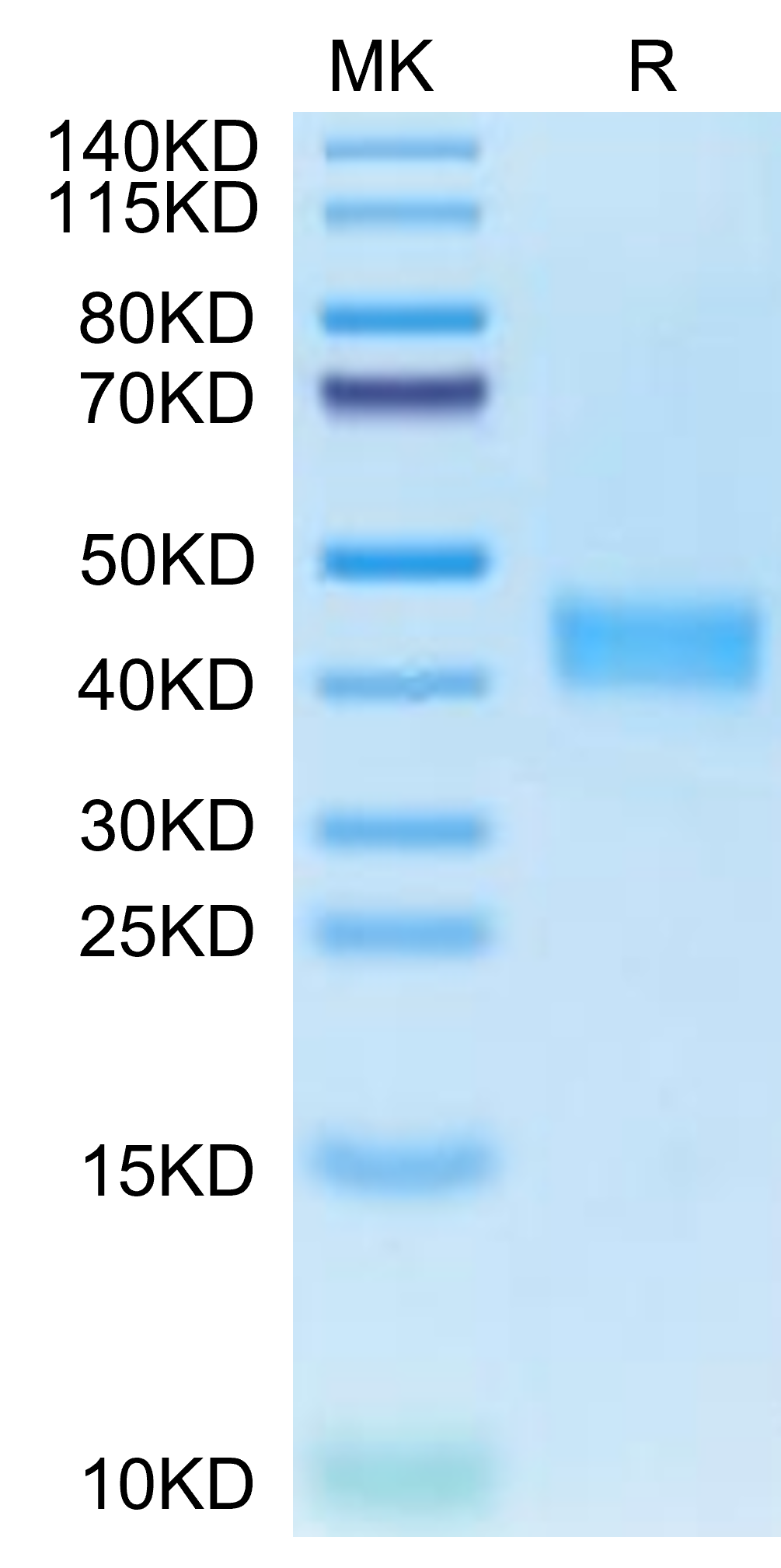 Human CA12/Carbonic anhydrase XII Protein (CAS-HM112)