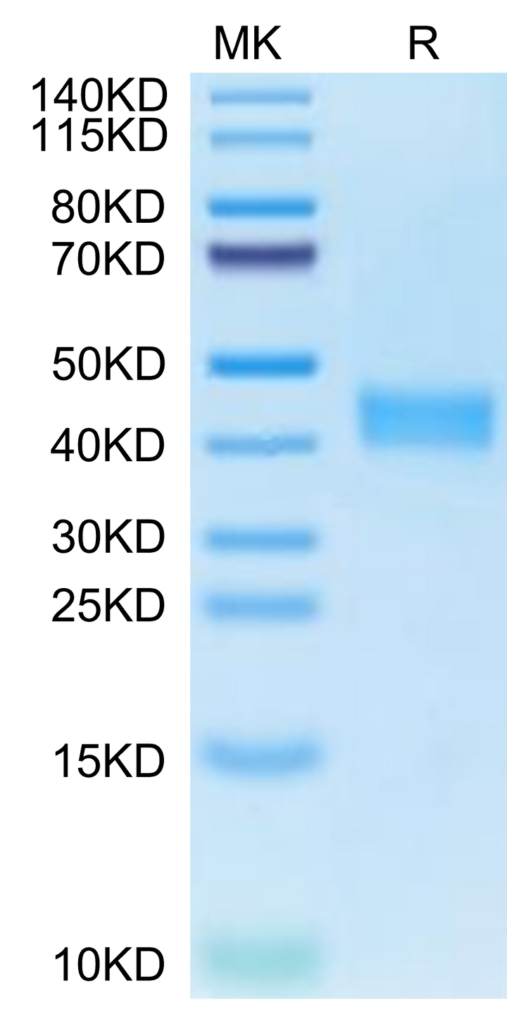 Human CA12/Carbonic anhydrase XII Protein (CAS-HM112)