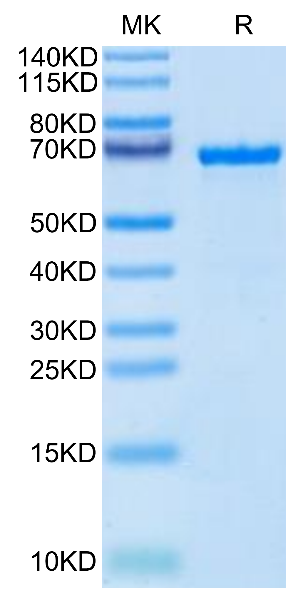 Cynomolgus AFP Protein, Ultra Low Endotoxin (AFP-CM101-UL)