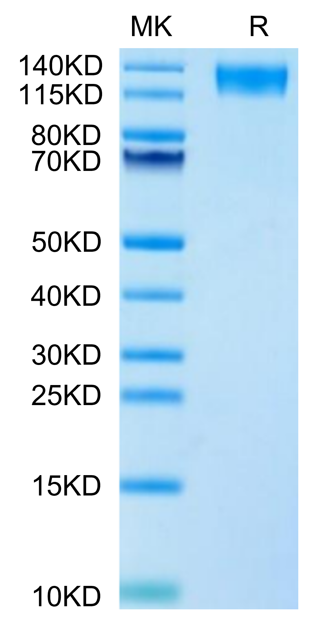 Human LEPR Protein, Ultra Low Endotoxin (LEP-HM10R-UL)