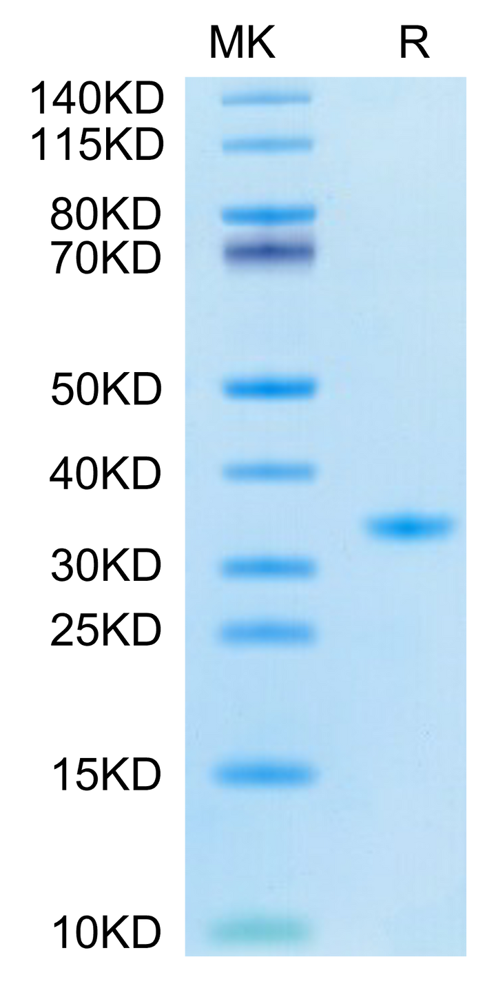 SARS-CoV-2 3CLpro/3C-like Protease Protein (F140A)  (COV-VE0LD)