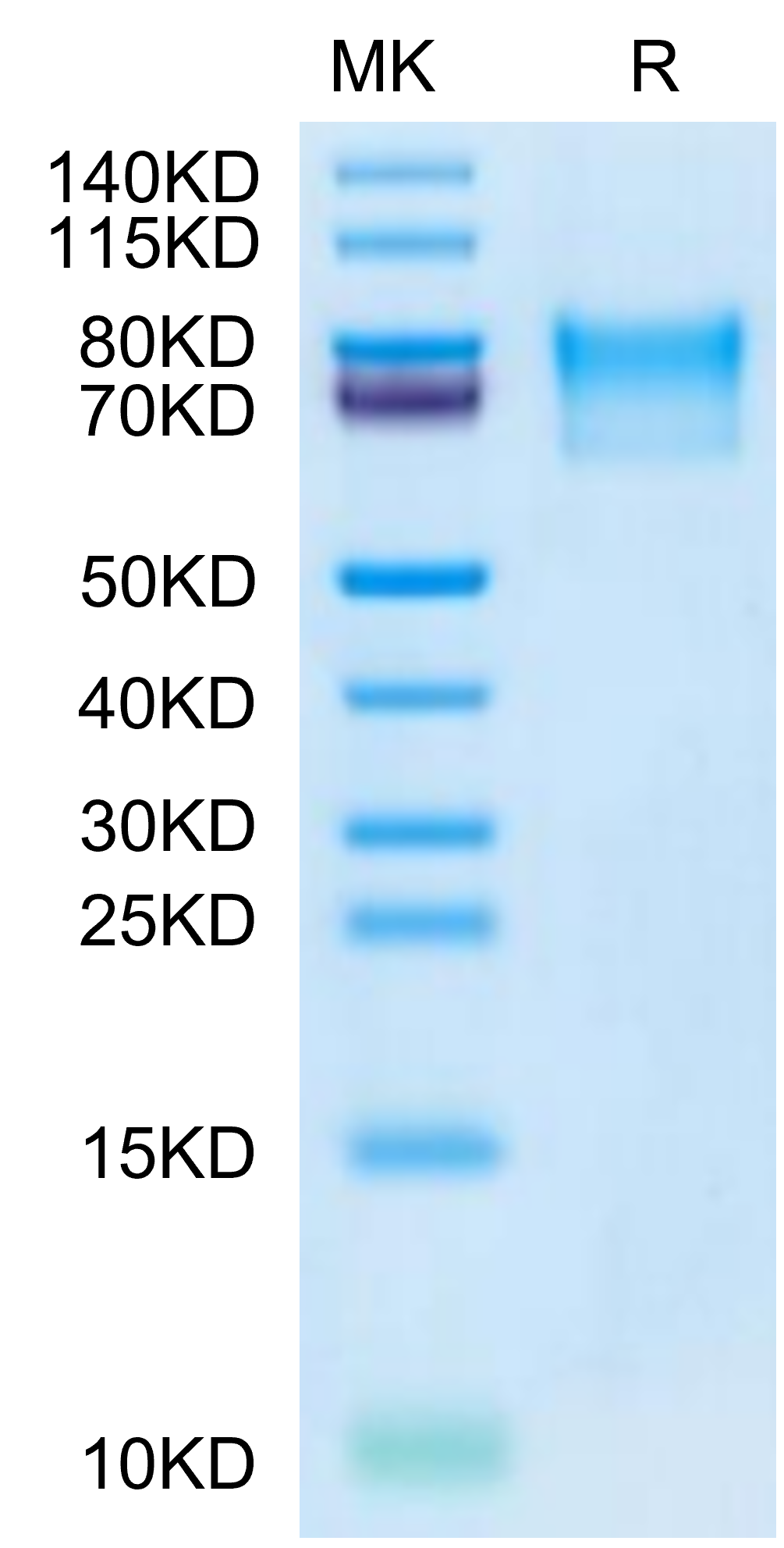 Varicella-zoster virus (strain Oka vaccine) Envelope glycoprotein E Protein (VZV-VM10E)