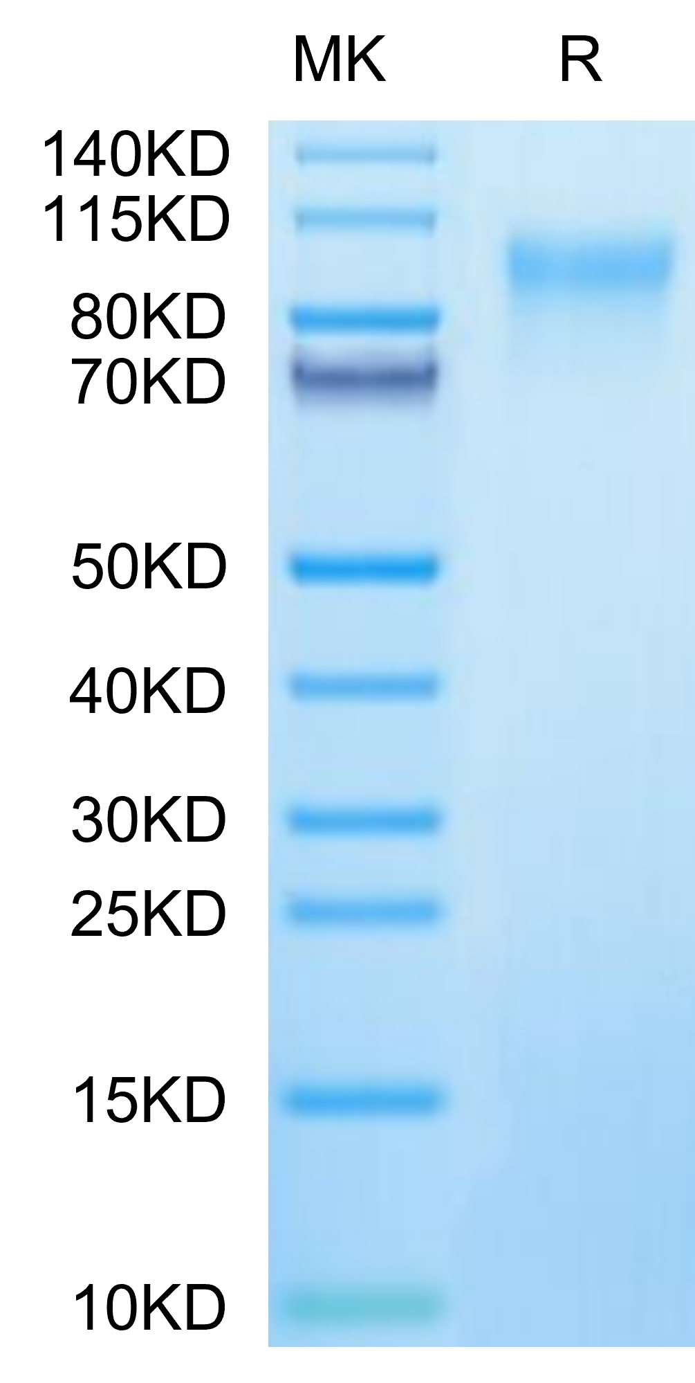 HRSV (A, strain Long) Glycoprotein G Protein, Ultra Low Endotoxin (HRV-VM10G-UL)