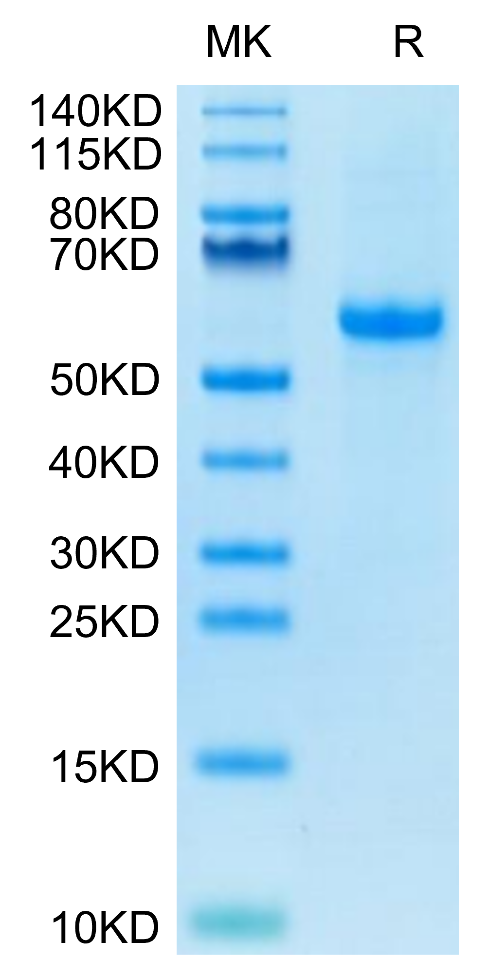 Biotinylated Human Notch 3 Protein (NOT-HM403B)