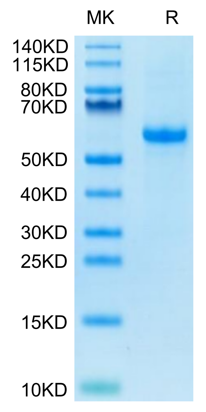 Biotinylated Human Notch 3 Protein (NOT-HM403B)