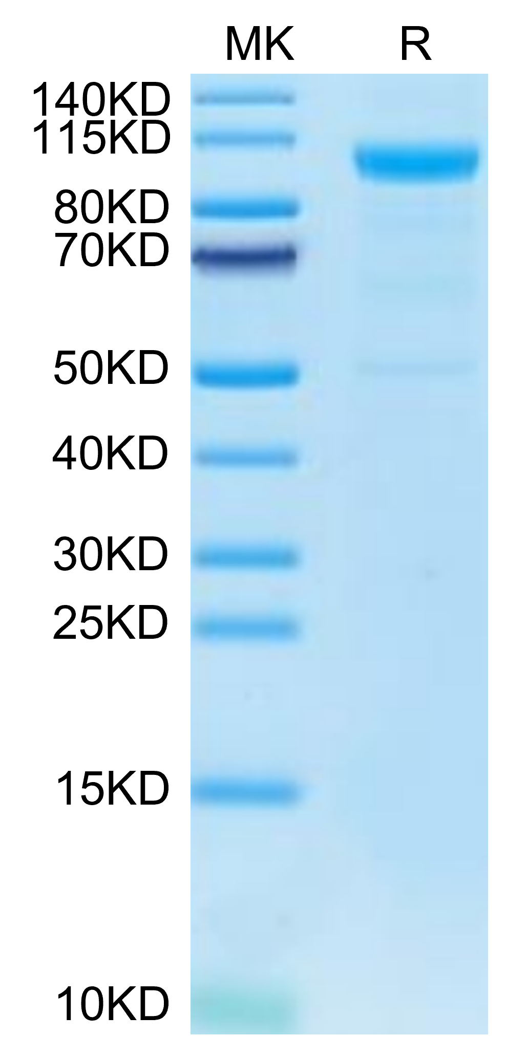 Human MASP3 Protein (MSP-HM103)