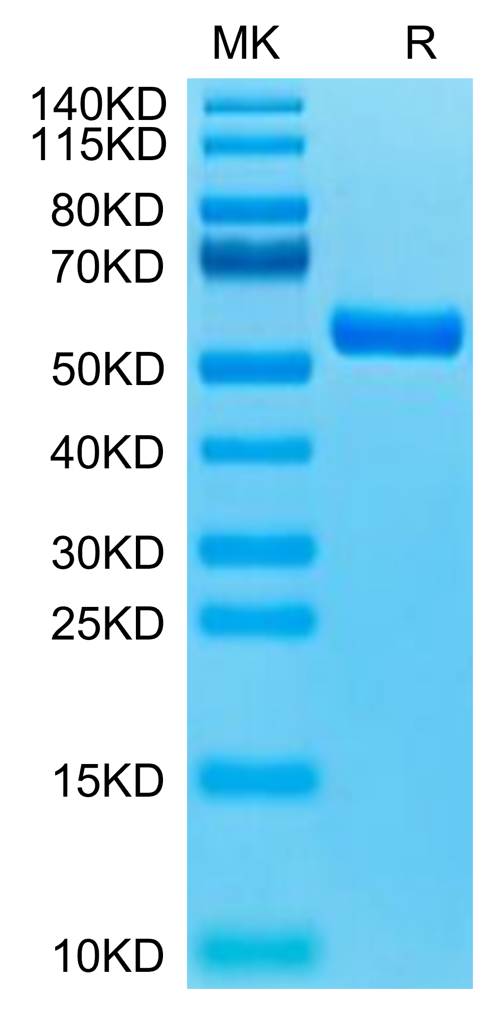 Biotinylated Human HLA-A*11:01&B2M&KRAS G12R (VVVGARGVGK) Monomer Protein (MHC-HM440B)