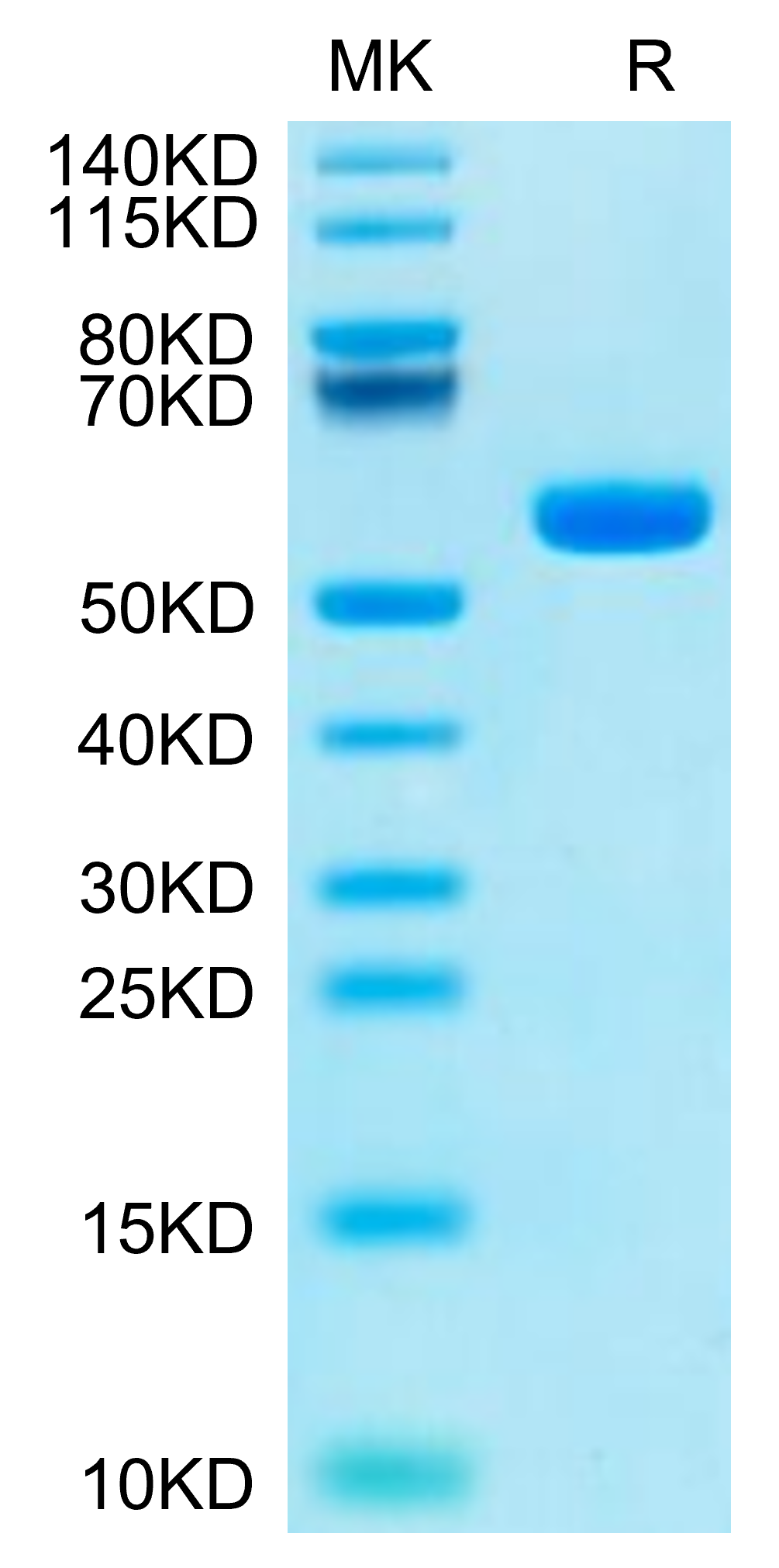 Human HLA-A*11:01&B2M&KRAS G12C (VVVGACGVGK) Monomer Protein (MHC-HM439)