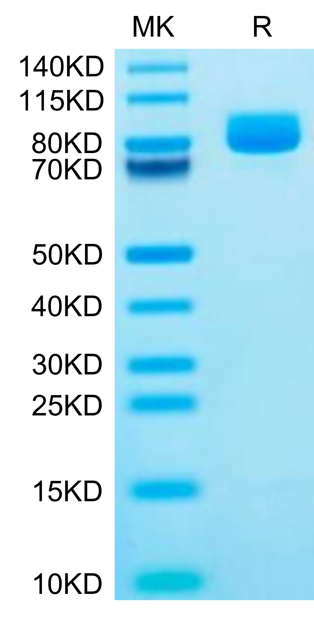 Mouse XPNPEP2 Protein (XPP-MM101)