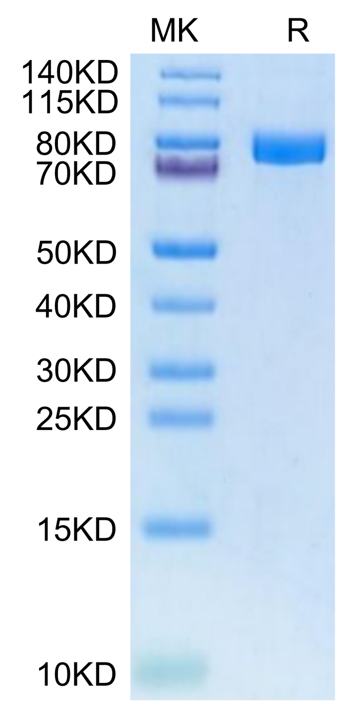 Human XPNPEP2 Protein (XPP-HM101)