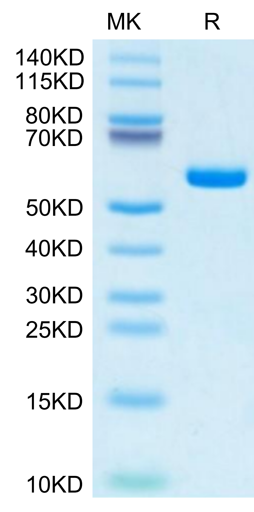 Human HLA-A*11:01&B2M&KRAS G12S (VVVGASGVGK) Monomer Protein (MHC-HM442)