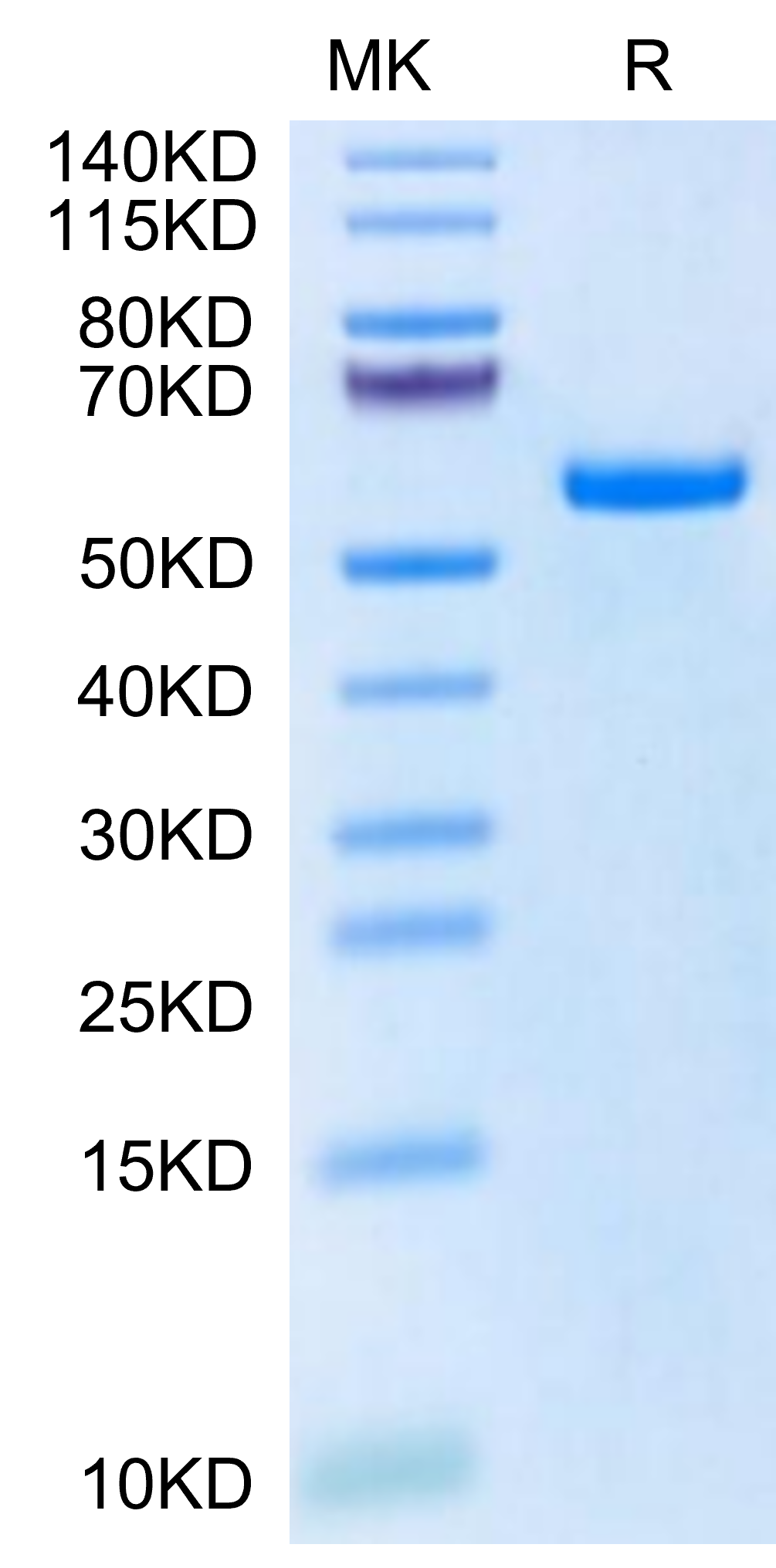 Biotinylated Human HLA-A*11:01&B2M&KRAS G12S (VVVGASGVGK) Monomer Protein (MHC-HM442B)