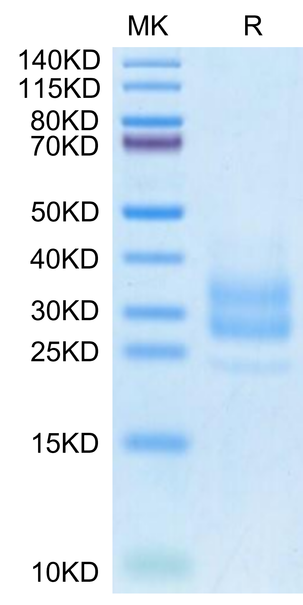 Monkeypox virus M1R Protein (M1R-VM11R)