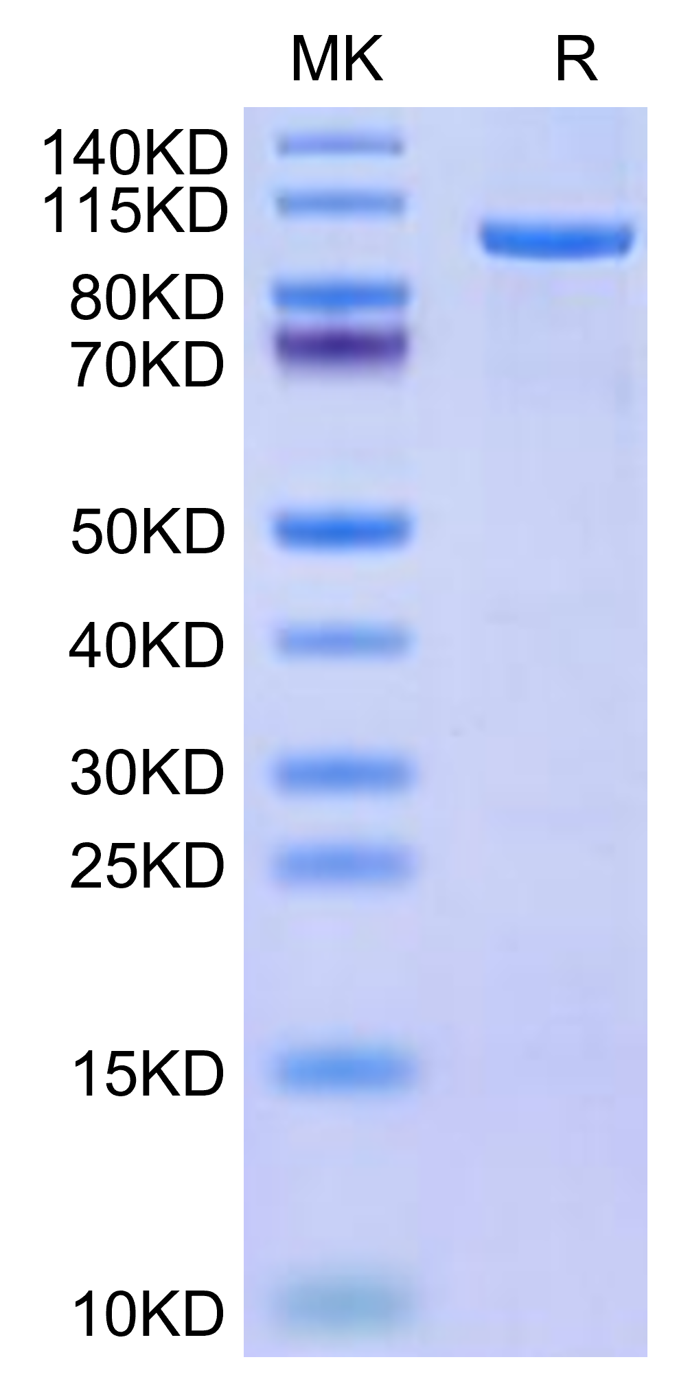 Human CDH19/Cadherin 19 Protein (CDH-HE019)