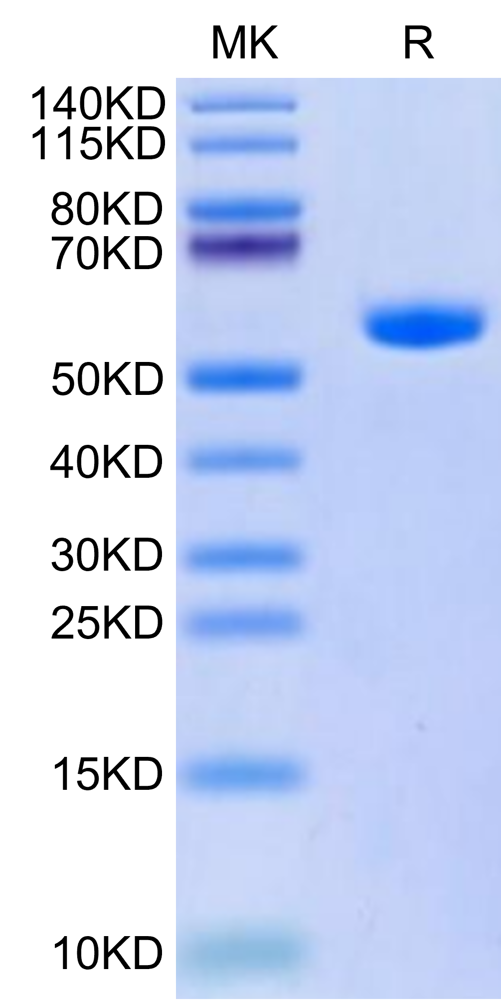 Human HLA-A*11:01&B2M&KRAS G12A (VVVGAAGVGK) Monomer Protein (MHC-HM441)