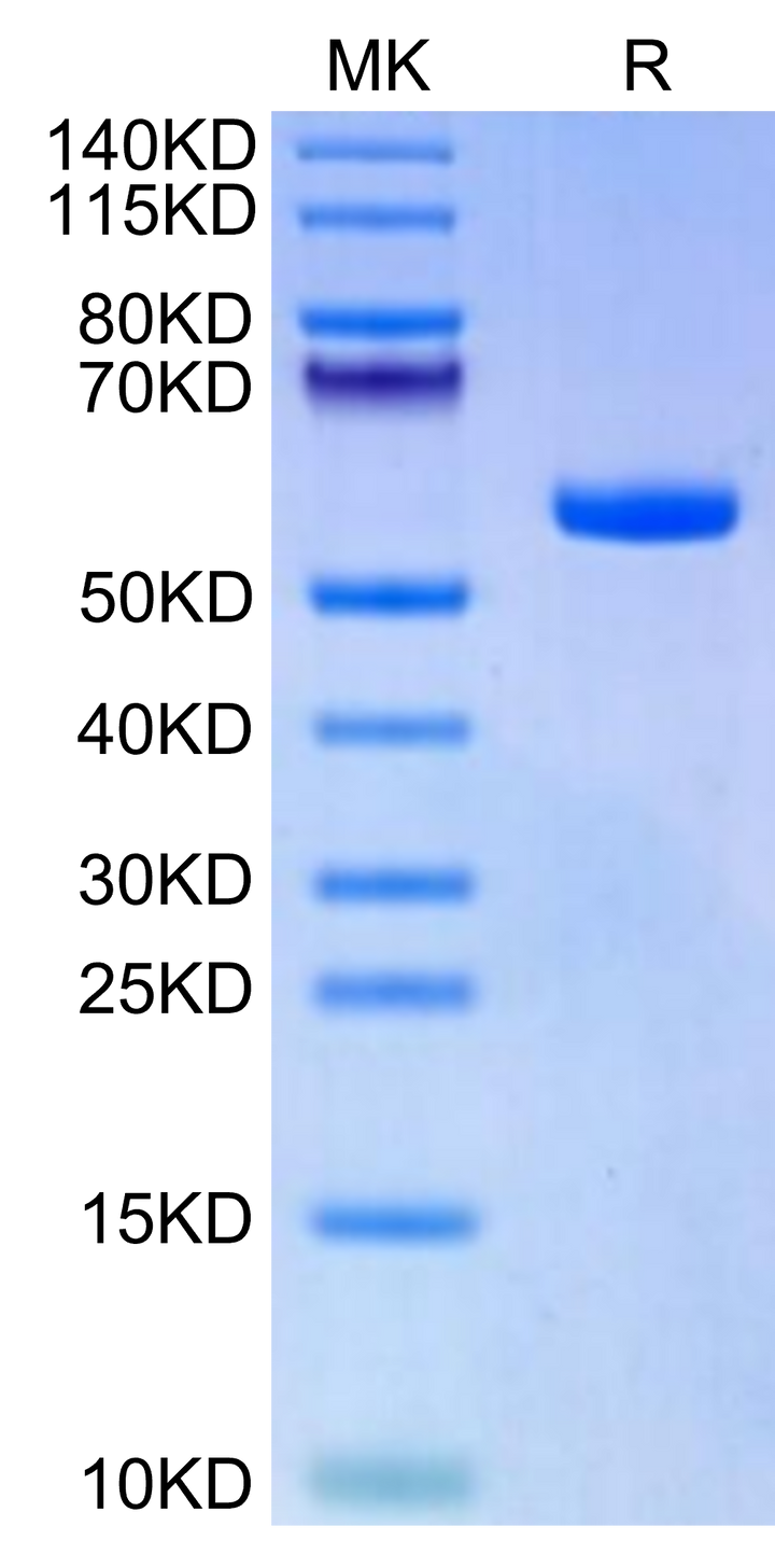 Biotinylated Human HLA-A*11:01&B2M&KRAS G12A (VVVGAAGVGK) Monomer Protein (MHC-HM441B)