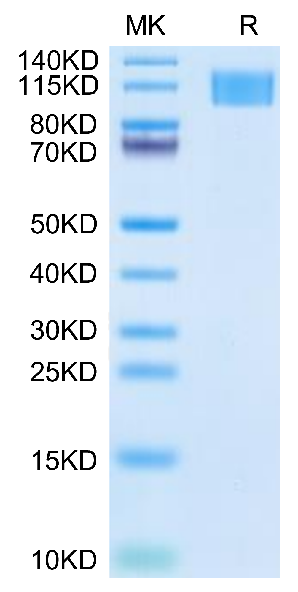 Human Aggrecan Protein (ARN-HM101)