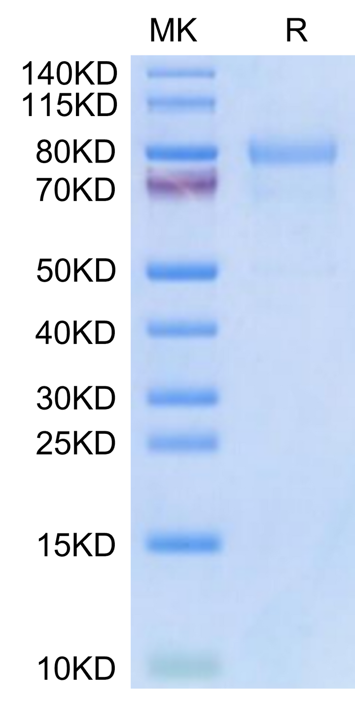 Mouse CDH6/Cadherin-6 Protein (CDH-MM106)