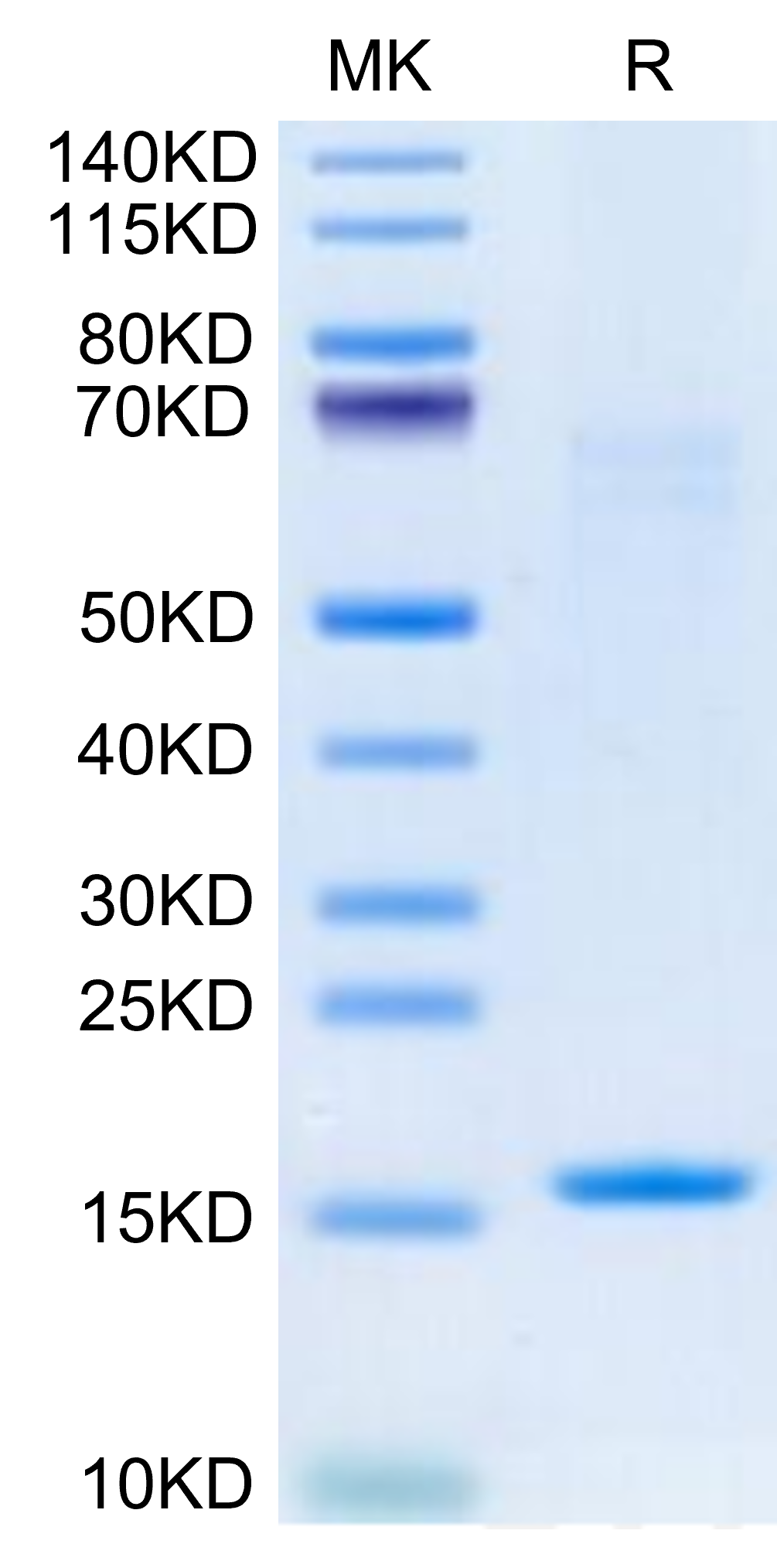 Human IL-3 Protein (IL3-HE003)