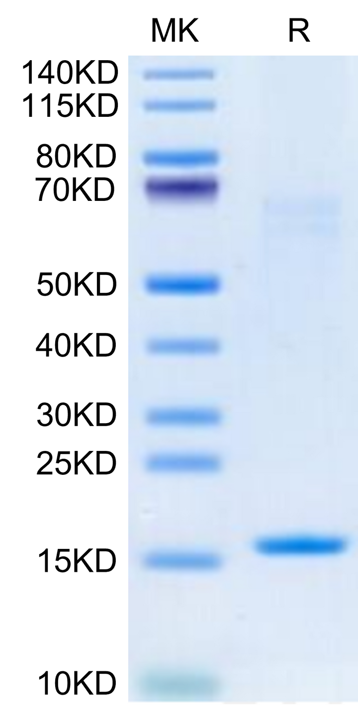 Human IL-3 Protein (IL3-HE003)