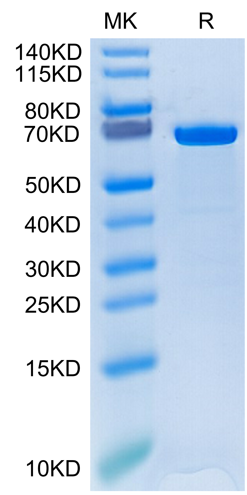 Human HSP70 Protein (HSP-HE170)