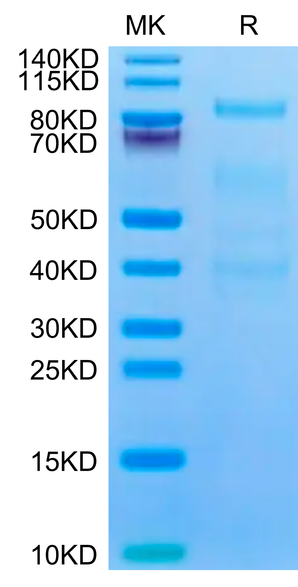 Mouse Complement Factor I Protein (CFI-MM101)