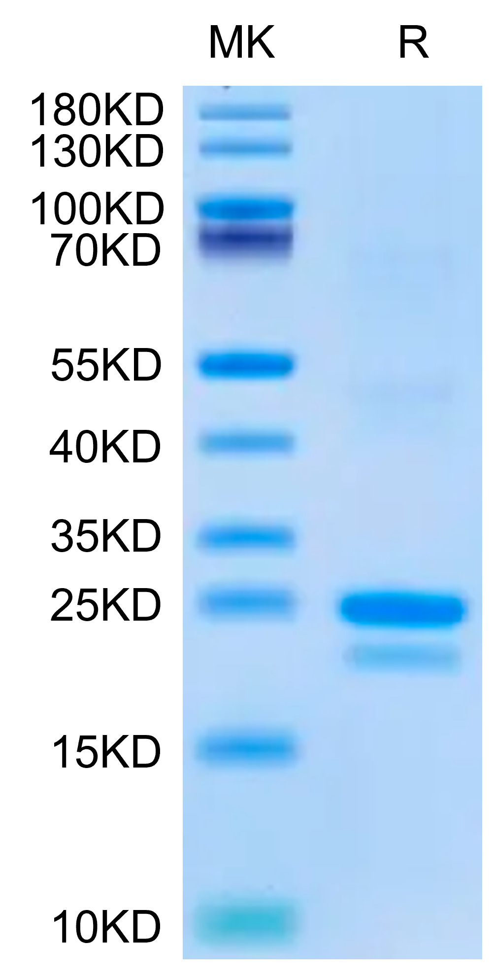 Mouse SP17 Protein (SP7-ME117)