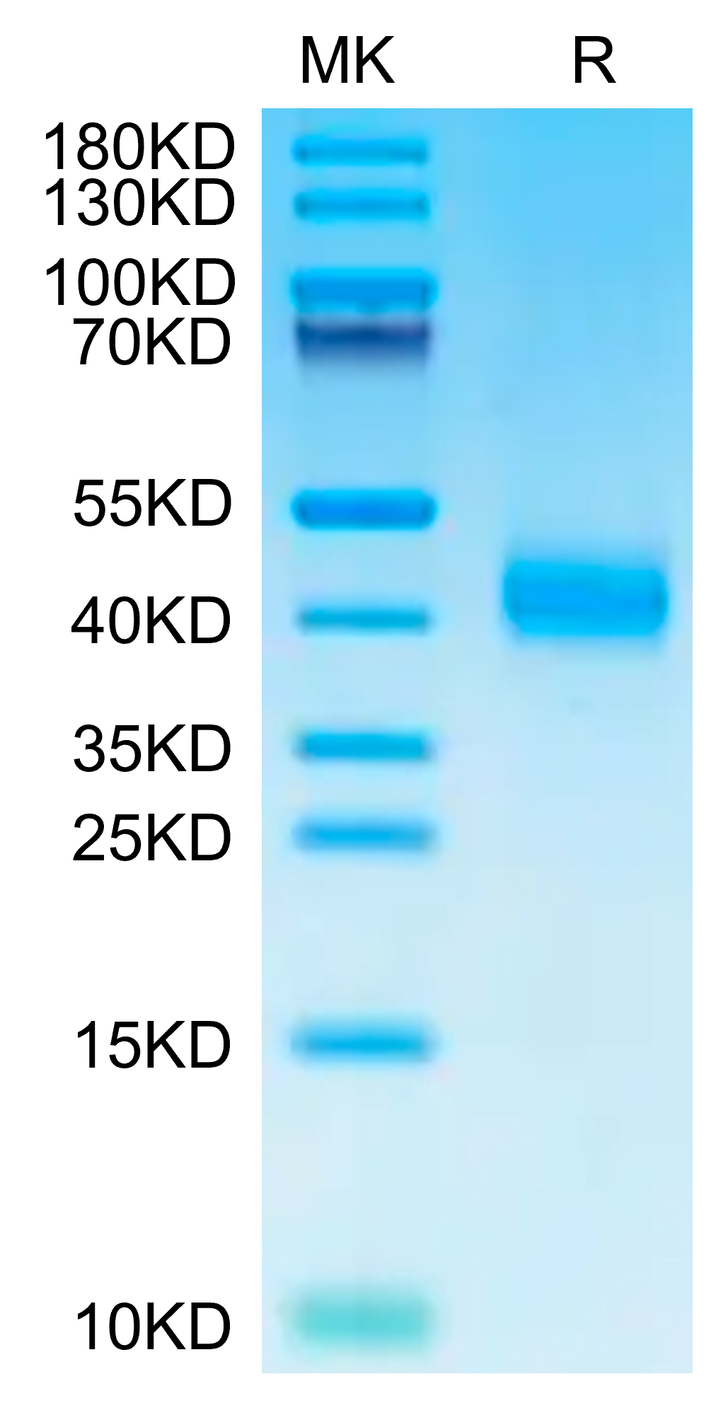 Human ASGR1 Protein, Ultra Low Endotoxin (ASG-HM1R1-UL)