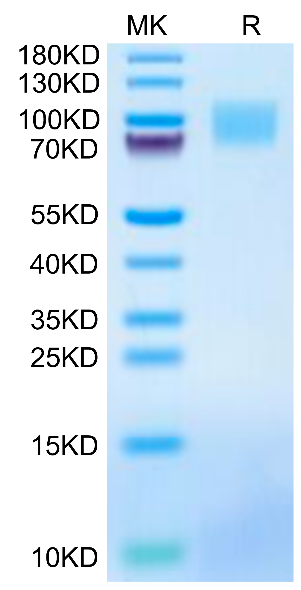 Mouse GUCY2C/Guanylyl cyclase C Protein (GCC-MM401)