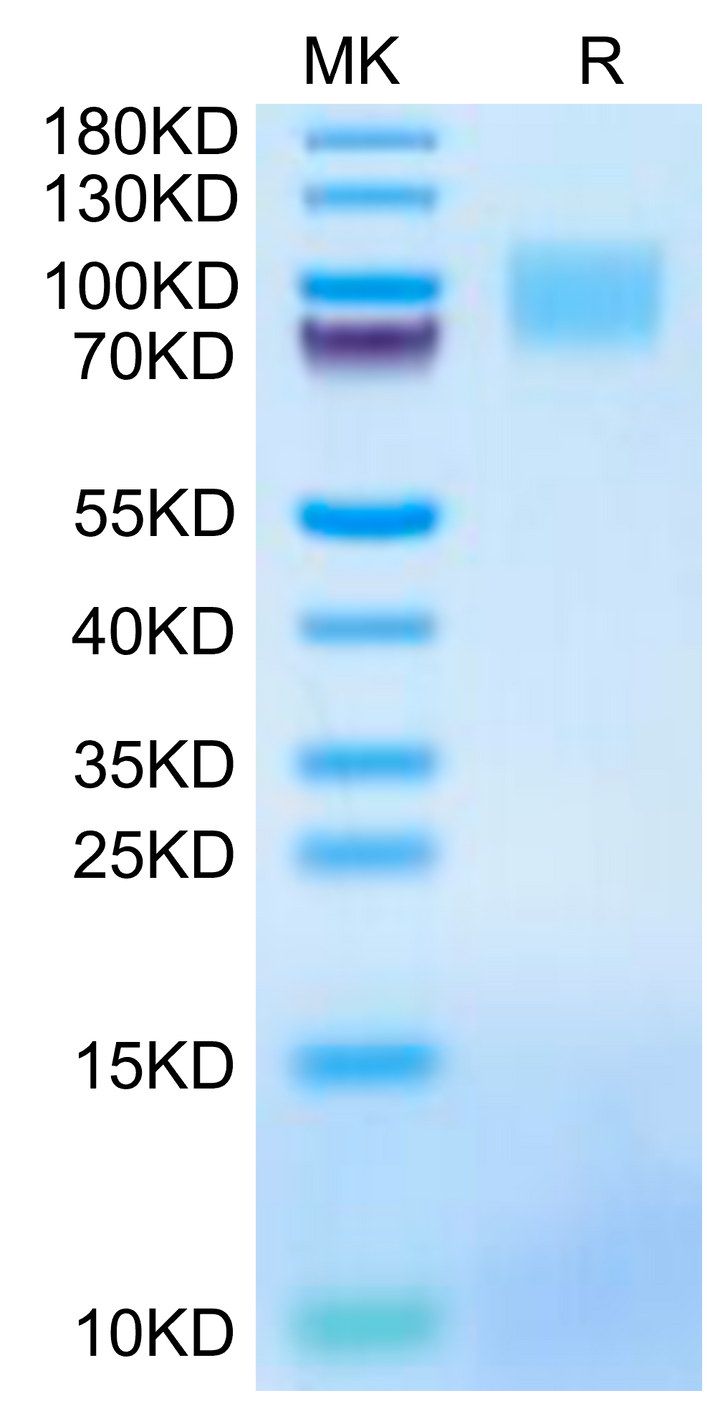 Mouse GUCY2C/Guanylyl cyclase C Protein (GCC-MM401)