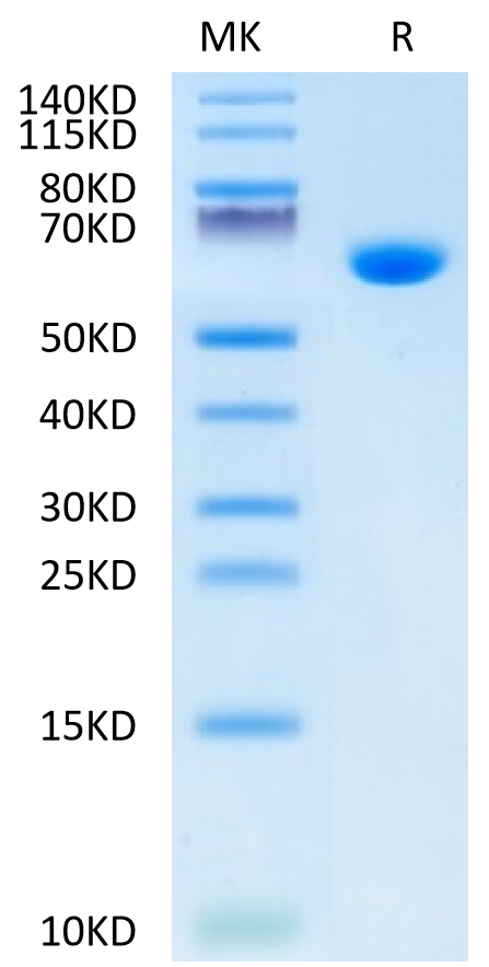 Mouse Alkaline Phosphatase (Germ type) /ALPG Protein (APE-MM103)