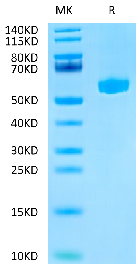 Mouse Hyaluronidase 2/HYAL2 Protein (HYA-MM101)