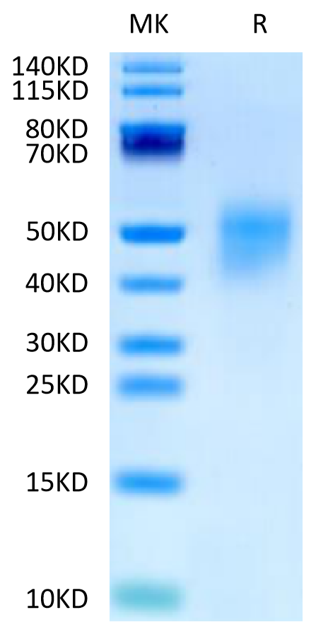 Human FGFR4 beta Protein (FGF-HM4RB)