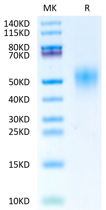 Biotinylated Human FGFR4 beta Protein (FGF-HM4RBB)